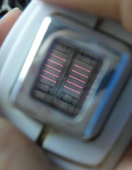 Ремонт лазеров для эпиляции в Ташкенте